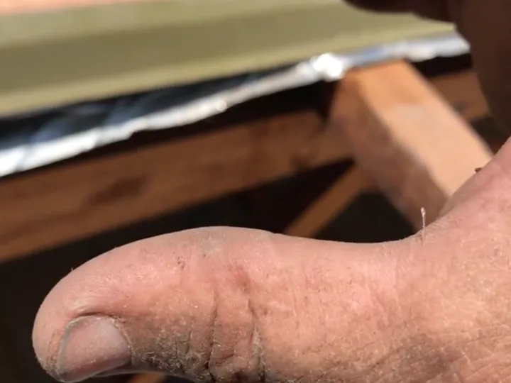 A 12 mm glass splinter pulled from a fibreglass roof-insulation batt, lodged in the installer's thumb, with a fibreglass batt and foil sarking blurred in the roof cavity behind